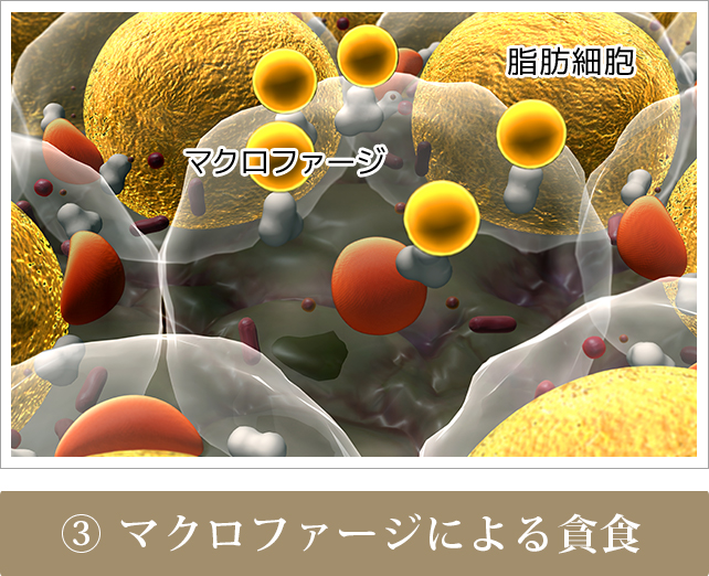 マクロファージ