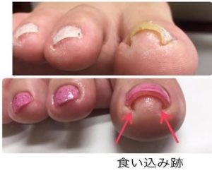 滋賀県大津市のネイルサロン