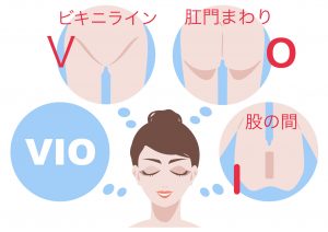 介護脱毛　ＶＩＯ脱毛　デリケートゾーン　恥ずかしい