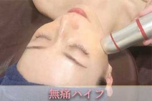 無痛ハイフ