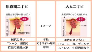 ニキビの原因　大人ニキビ　思春期ニキビ　ニキビの違い　ビュキュア　エステサロン　滋賀　大津