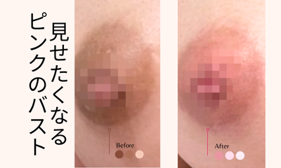 メラニンケアバスト